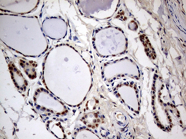MEIS1 Antibody in Immunohistochemistry (Paraffin) (IHC (P))