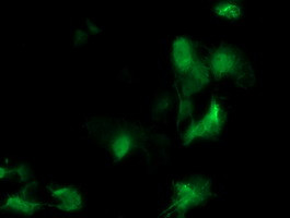 MEIS3 Antibody in Immunocytochemistry (ICC/IF)