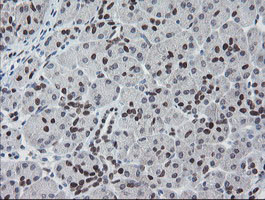 MEIS3 Antibody in Immunohistochemistry (Paraffin) (IHC (P))
