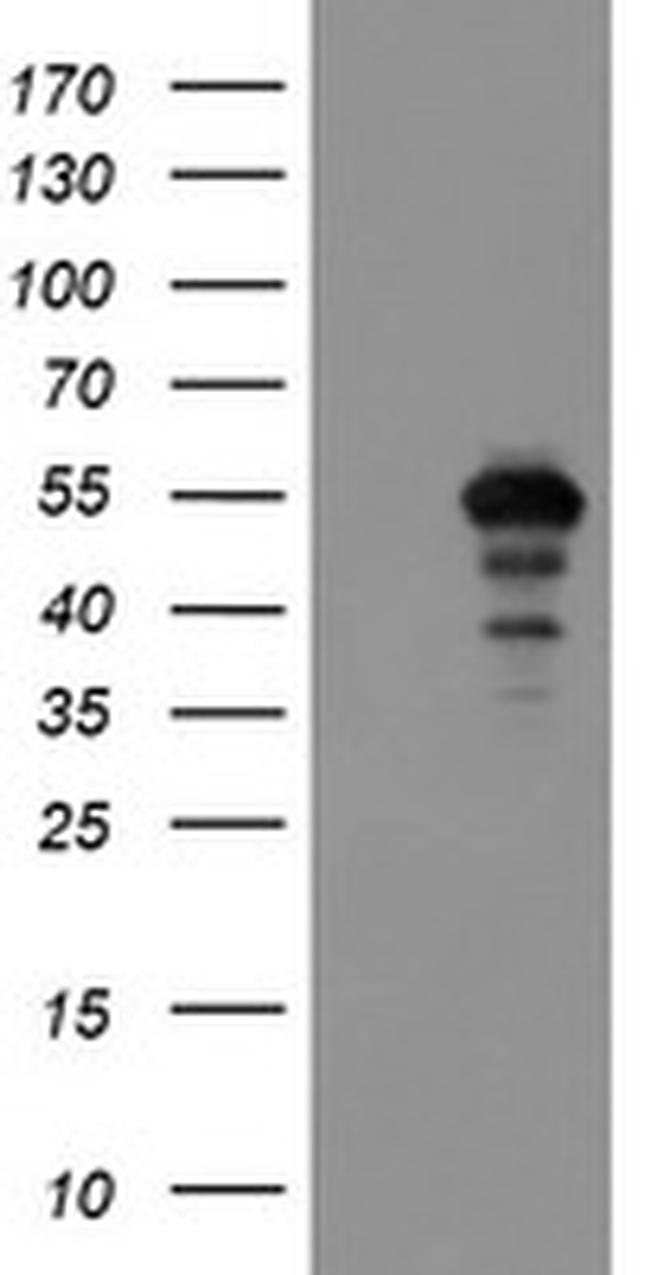 MEIS3 Antibody in Western Blot (WB)