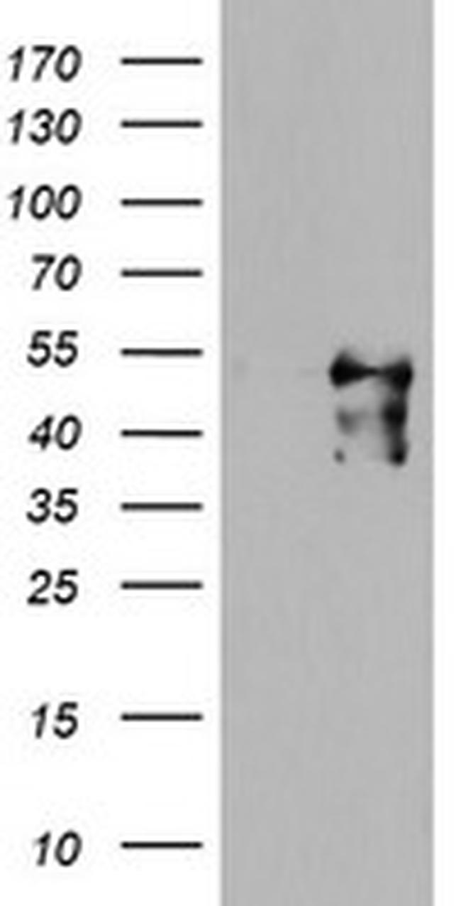 MEIS3 Antibody in Western Blot (WB)