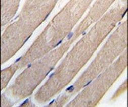 MAP2K4 Antibody in Immunohistochemistry (IHC)
