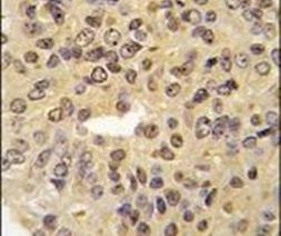 Menin Antibody in Immunohistochemistry (IHC)