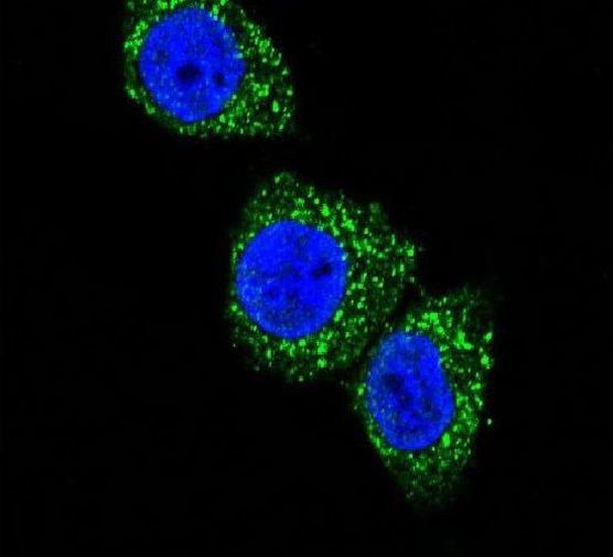 Menin Antibody in Immunocytochemistry (ICC/IF)