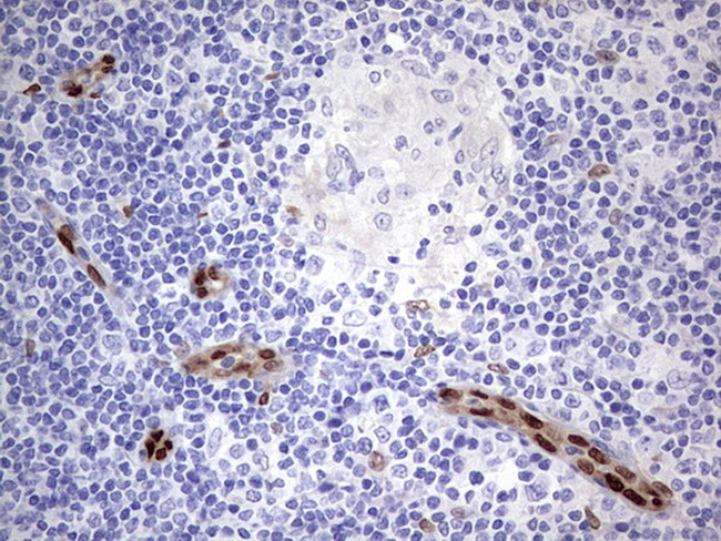 MEOX1 Antibody in Immunohistochemistry (Paraffin) (IHC (P))