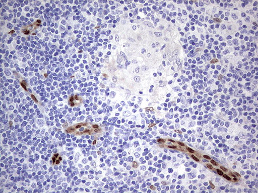 MEOX1 Antibody in Immunohistochemistry (Paraffin) (IHC (P))