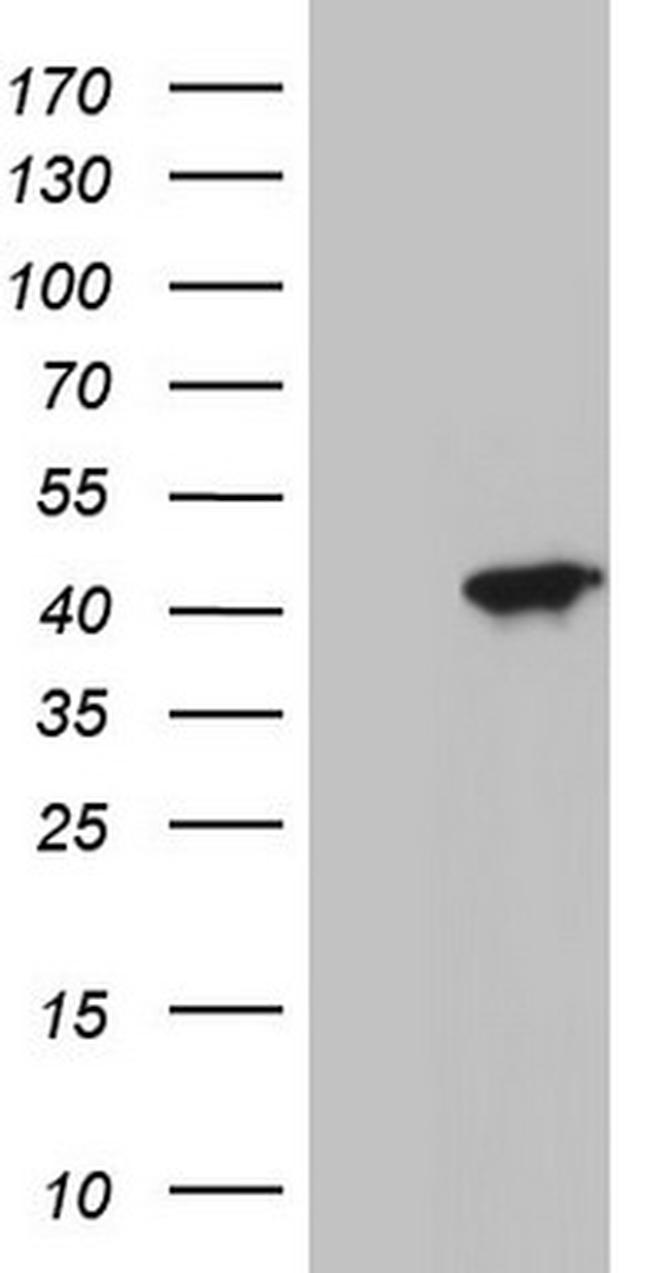 MEOX1 Antibody in Western Blot (WB)