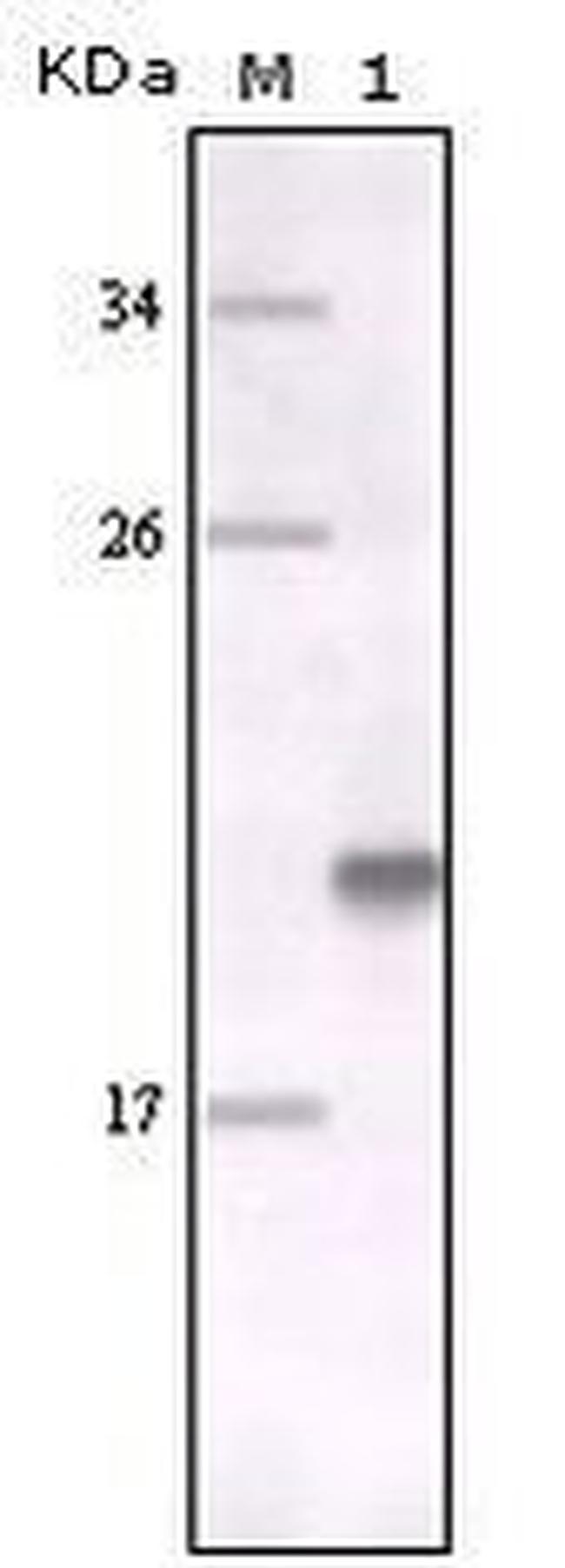 MERTK Antibody in Western Blot (WB)
