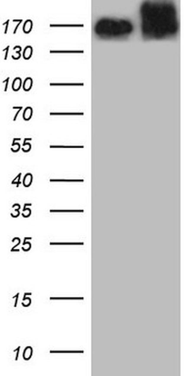 MET Antibody in Western Blot (WB)