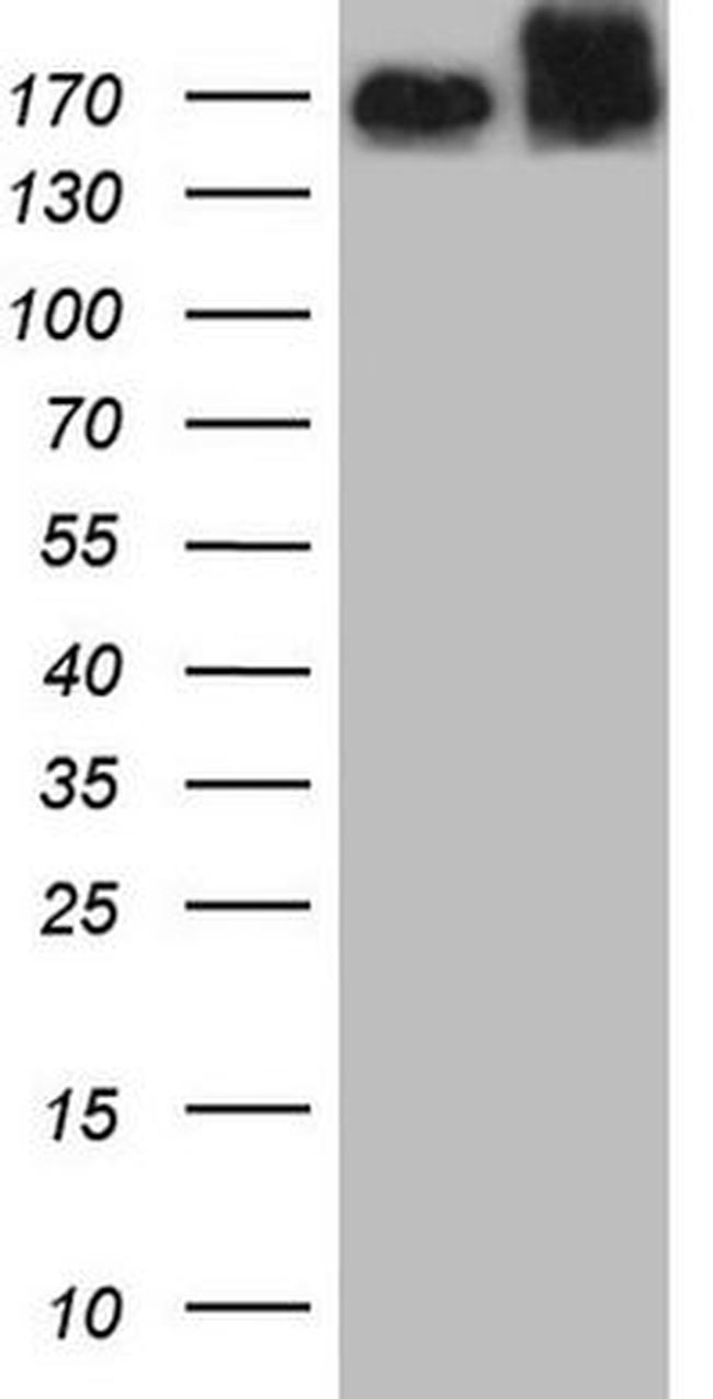 MET Antibody in Western Blot (WB)