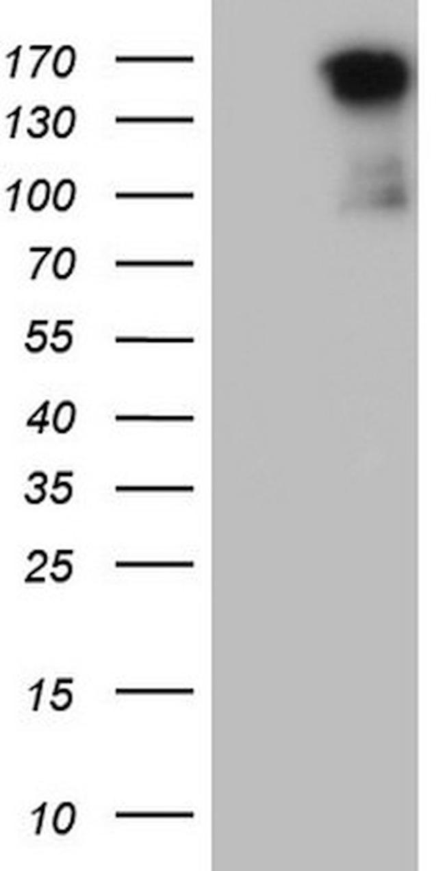 MET Antibody in Western Blot (WB)