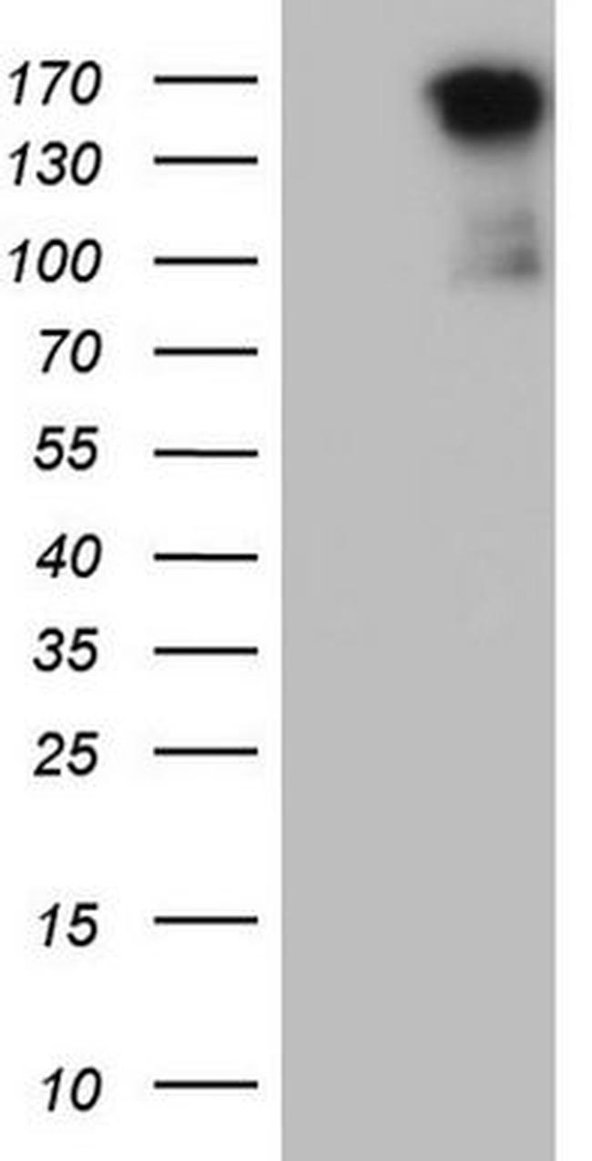 MET Antibody in Western Blot (WB)