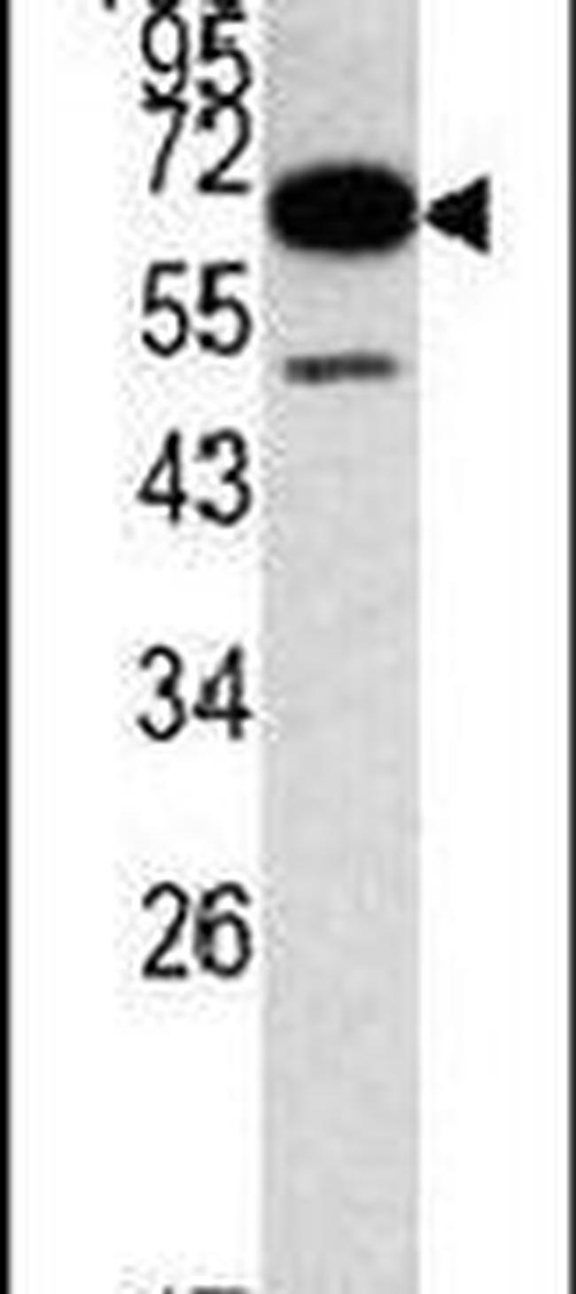 METAP2 Antibody in Western Blot (WB)