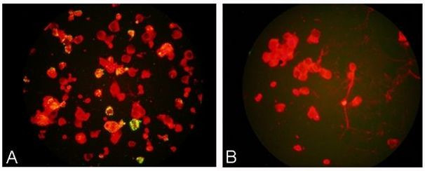 Metapneumovirus Antibody in Immunocytochemistry (ICC/IF)