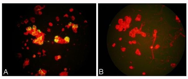 Metapneumovirus Antibody in Immunocytochemistry (ICC/IF)