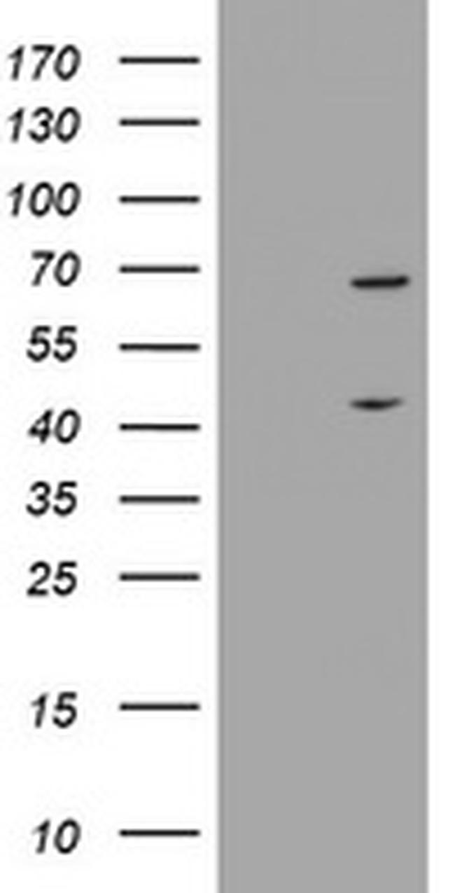 METT10D Antibody in Western Blot (WB)