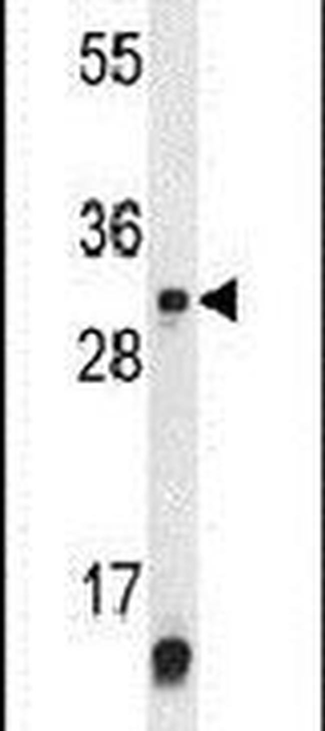 METTL1 Antibody in Western Blot (WB)