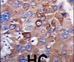 METTL7A Antibody in Immunohistochemistry (IHC)