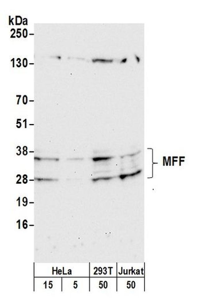 MFF Antibody in Western Blot (WB)