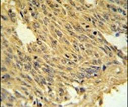 SLC25A28 Antibody in Immunohistochemistry (IHC)