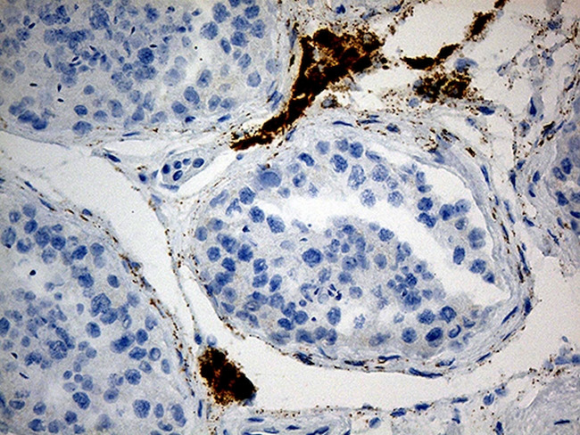 MGARP Antibody in Immunohistochemistry (Paraffin) (IHC (P))