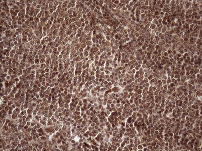 MGC12965 Antibody in Immunohistochemistry (Paraffin) (IHC (P))