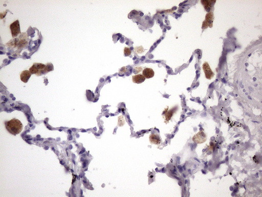 MGC12965 Antibody in Immunohistochemistry (Paraffin) (IHC (P))