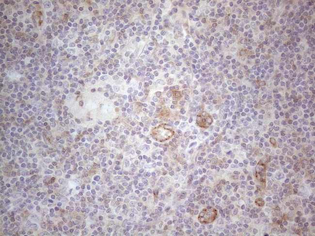 MGC12965 Antibody in Immunohistochemistry (Paraffin) (IHC (P))