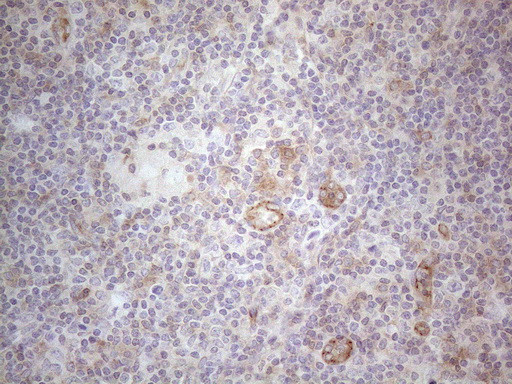 MGC12965 Antibody in Immunohistochemistry (Paraffin) (IHC (P))