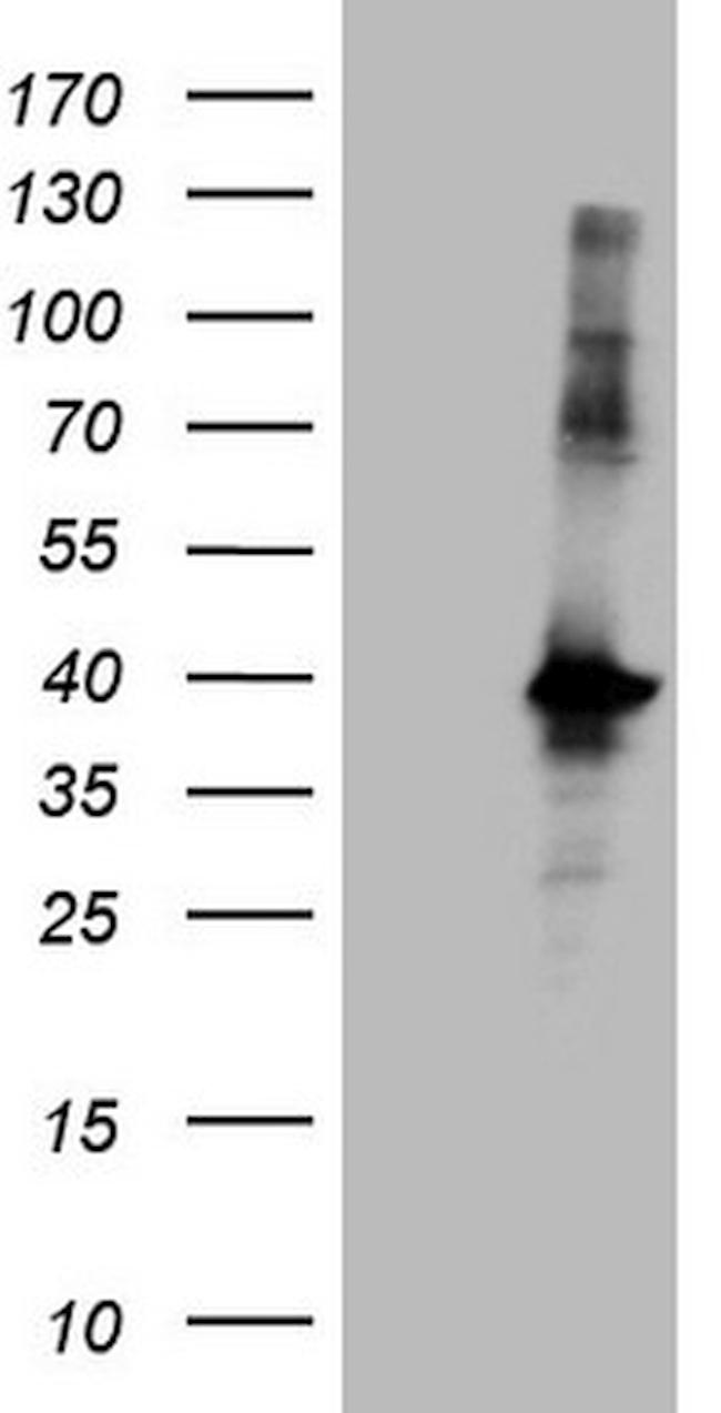 MGC12965 Antibody in Western Blot (WB)