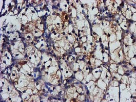 MGLL Antibody in Immunohistochemistry (Paraffin) (IHC (P))