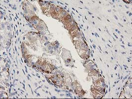 MGLL Antibody in Immunohistochemistry (Paraffin) (IHC (P))