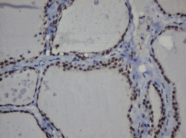 MGMT Antibody in Immunohistochemistry (Paraffin) (IHC (P))