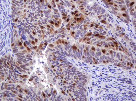 MGMT Antibody in Immunohistochemistry (Paraffin) (IHC (P))
