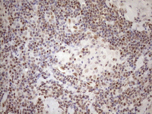 MGMT Antibody in Immunohistochemistry (Paraffin) (IHC (P))