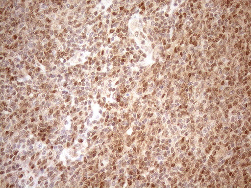 MGMT Antibody in Immunohistochemistry (Paraffin) (IHC (P))