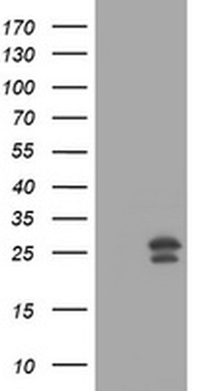 MGMT Antibody in Western Blot (WB)