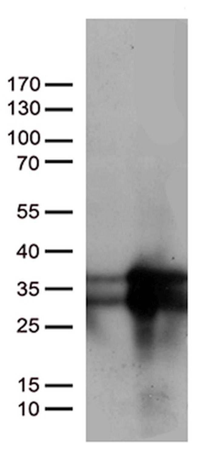 MGMT Antibody in Western Blot (WB)