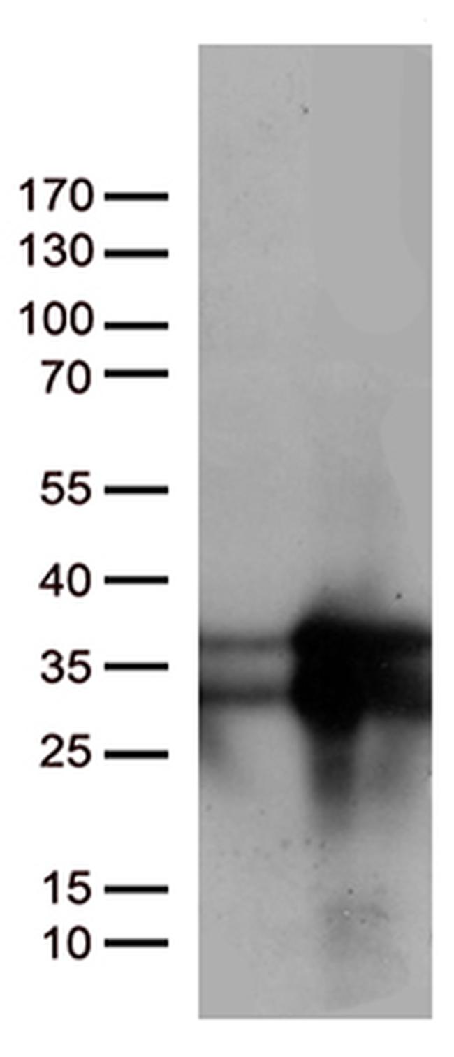 MGMT Antibody in Western Blot (WB)