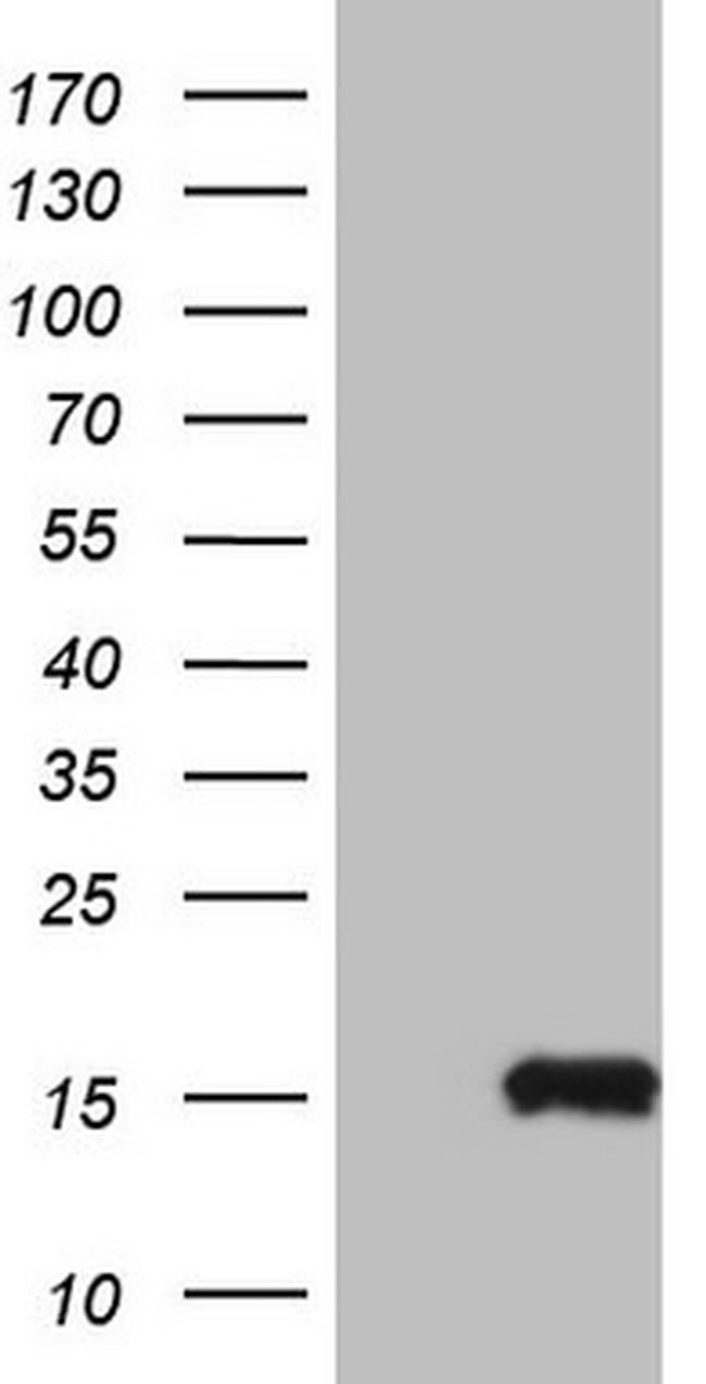 MGP Antibody in Western Blot (WB)