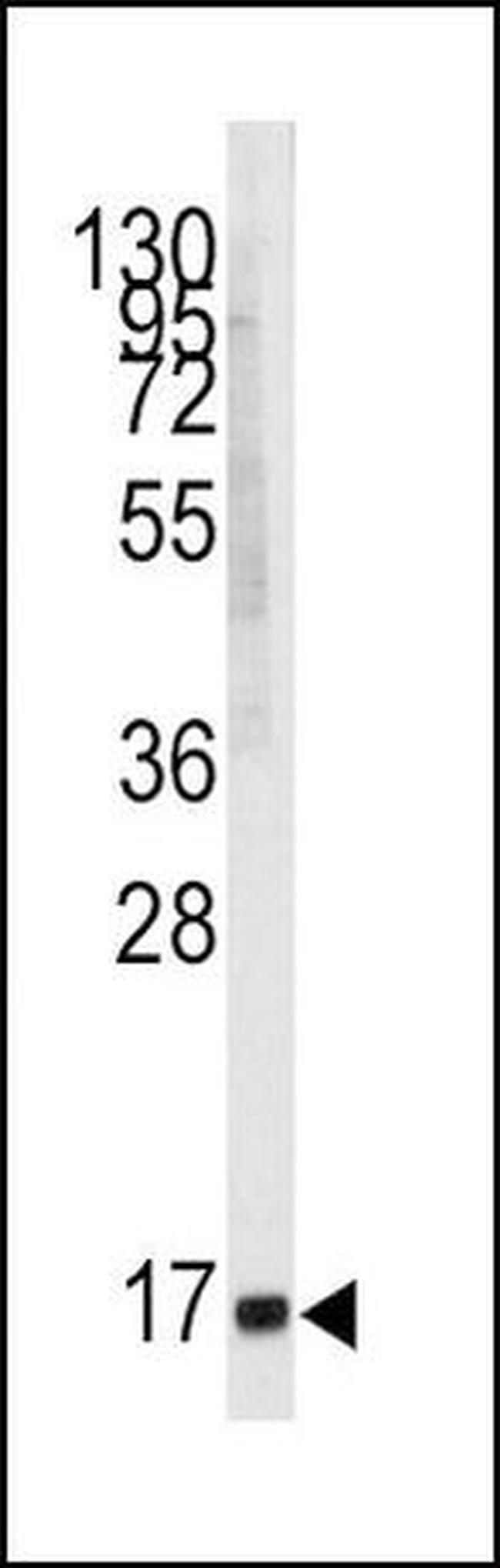 MGST1 Antibody in Western Blot (WB)