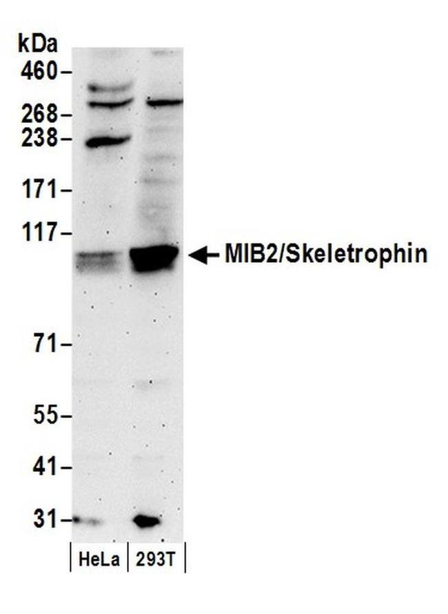 MIB2/Skeletrophin Antibody in Western Blot (WB)