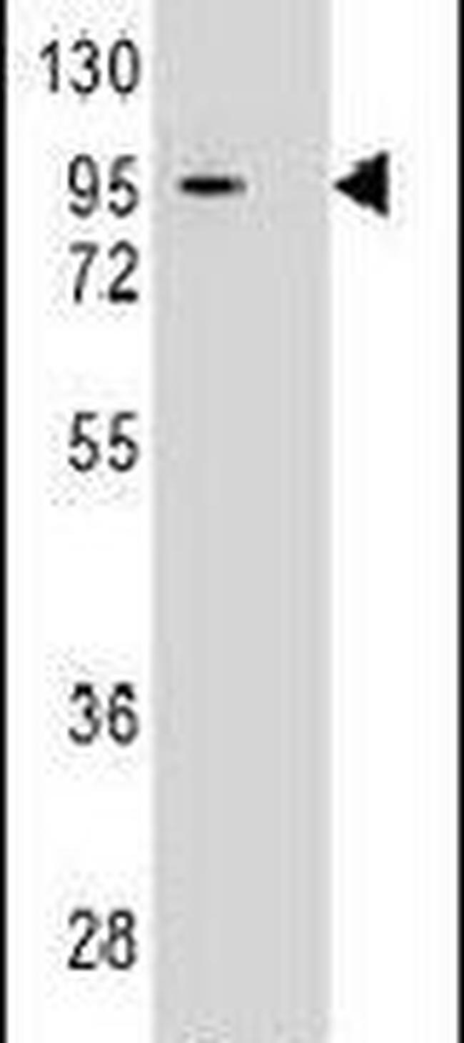 MIC-1 Antibody in Western Blot (WB)