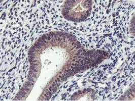 MIER2 Antibody in Immunohistochemistry (Paraffin) (IHC (P))