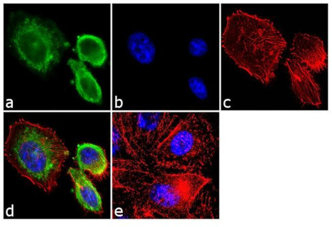 Follicle Stimulating Hormone Antibody in Immunocytochemistry (ICC/IF)