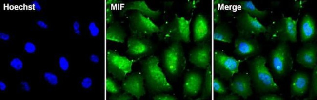 MIF Antibody in Immunocytochemistry (ICC/IF)