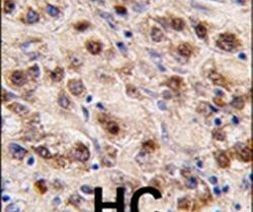 MINA53 Antibody in Immunohistochemistry (IHC)