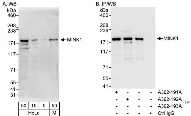 MINK1 Antibody in Western Blot (WB)