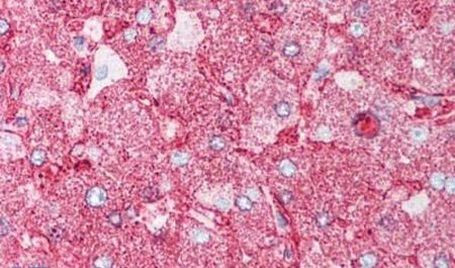 MINK1 Antibody in Immunohistochemistry (Paraffin) (IHC (P))