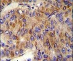 MINPP1 Antibody in Immunohistochemistry (IHC)